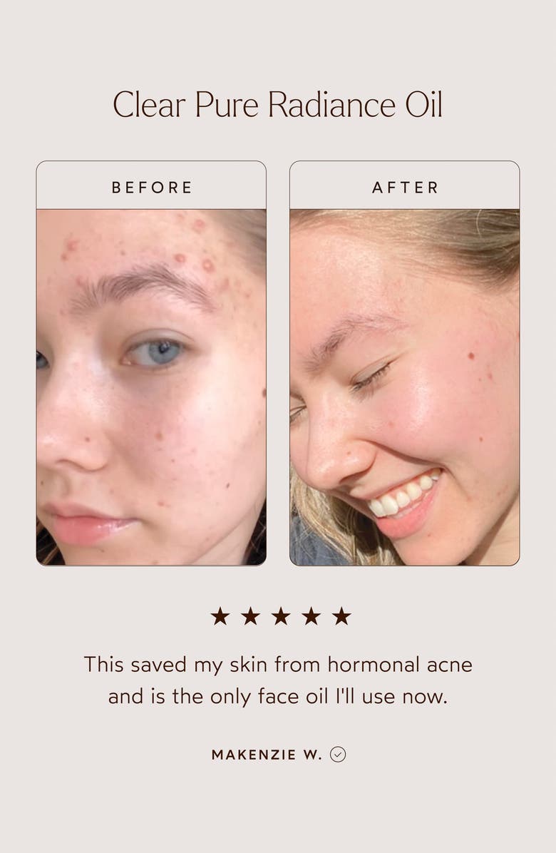 True Botanicals Clear Pure Radiance Oil, Alternate, color,