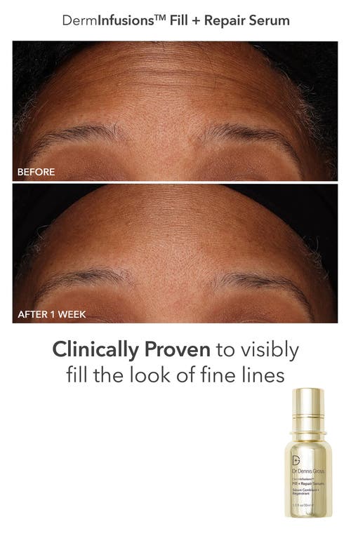 Dr Dennis Gross Skincare Fill, Plump & Firm Derminfusions Gift Set In Transparent