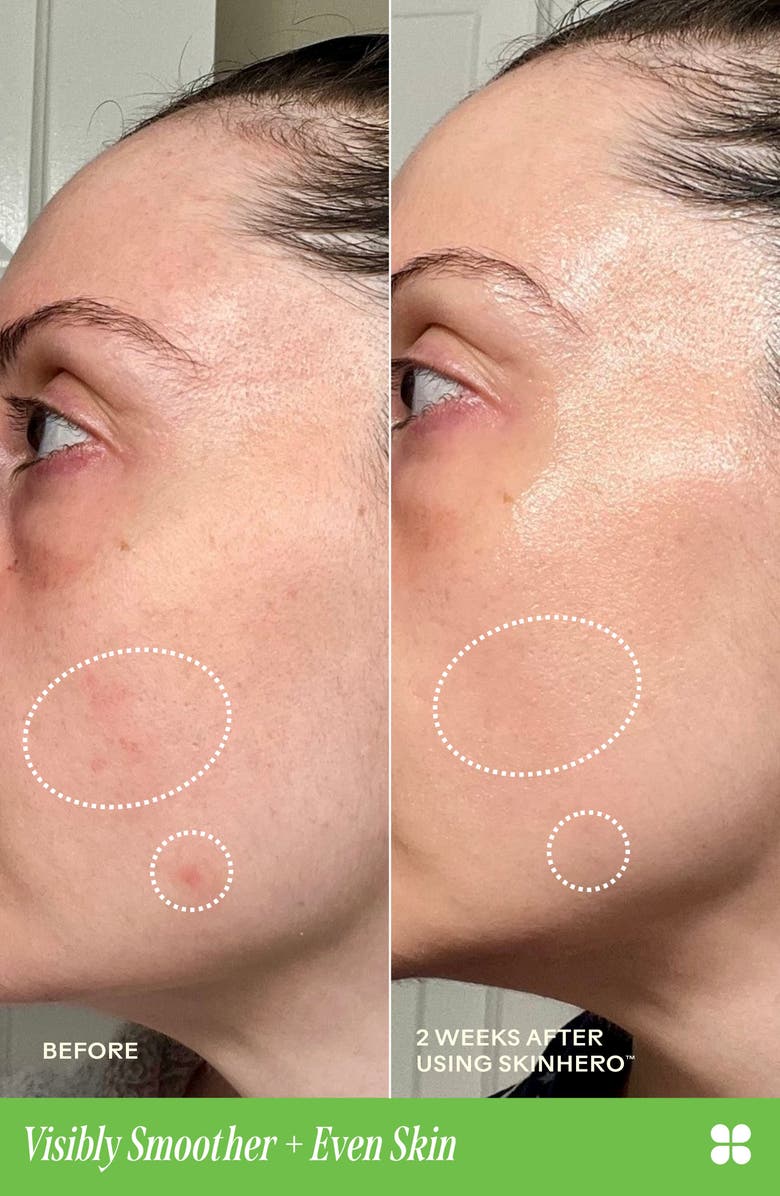 Three Ships SkinHero<sup>™</sup> Calendula + 2% Bakuchiol Bio-Retinol Serum, Alternate, color,