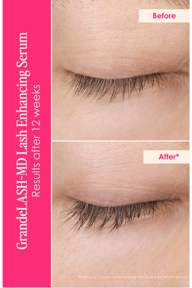 Dynamite Lashes & Brows Set $156 Value, Alternate, color, BLACK