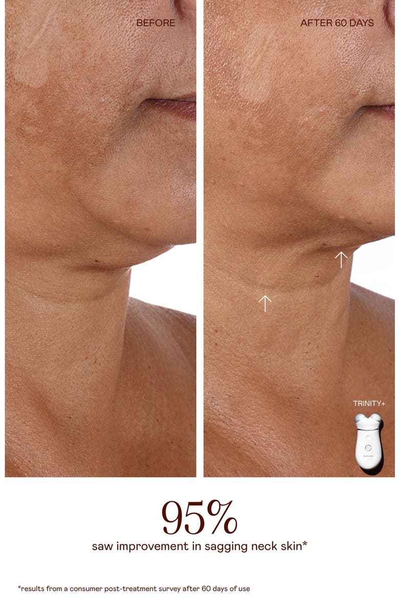 TRINITY+ Complete Microcurrent & Red Light Facial Toning Device Set, Alternate, color, NO COLOR