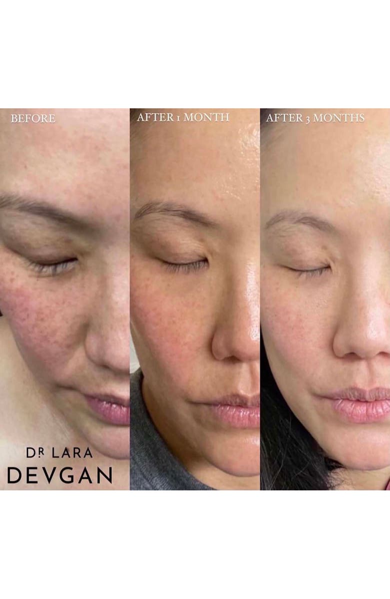 Dr. Lara Devgan Vitamin C+B+E Ferulic Serum, Alternate, color, 