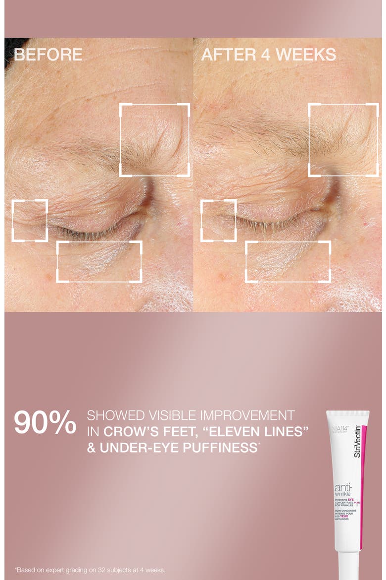 Tighten & Smooth Skin Care Set (Limited Edition) $146 Value, Alternate, color, NO COLOR