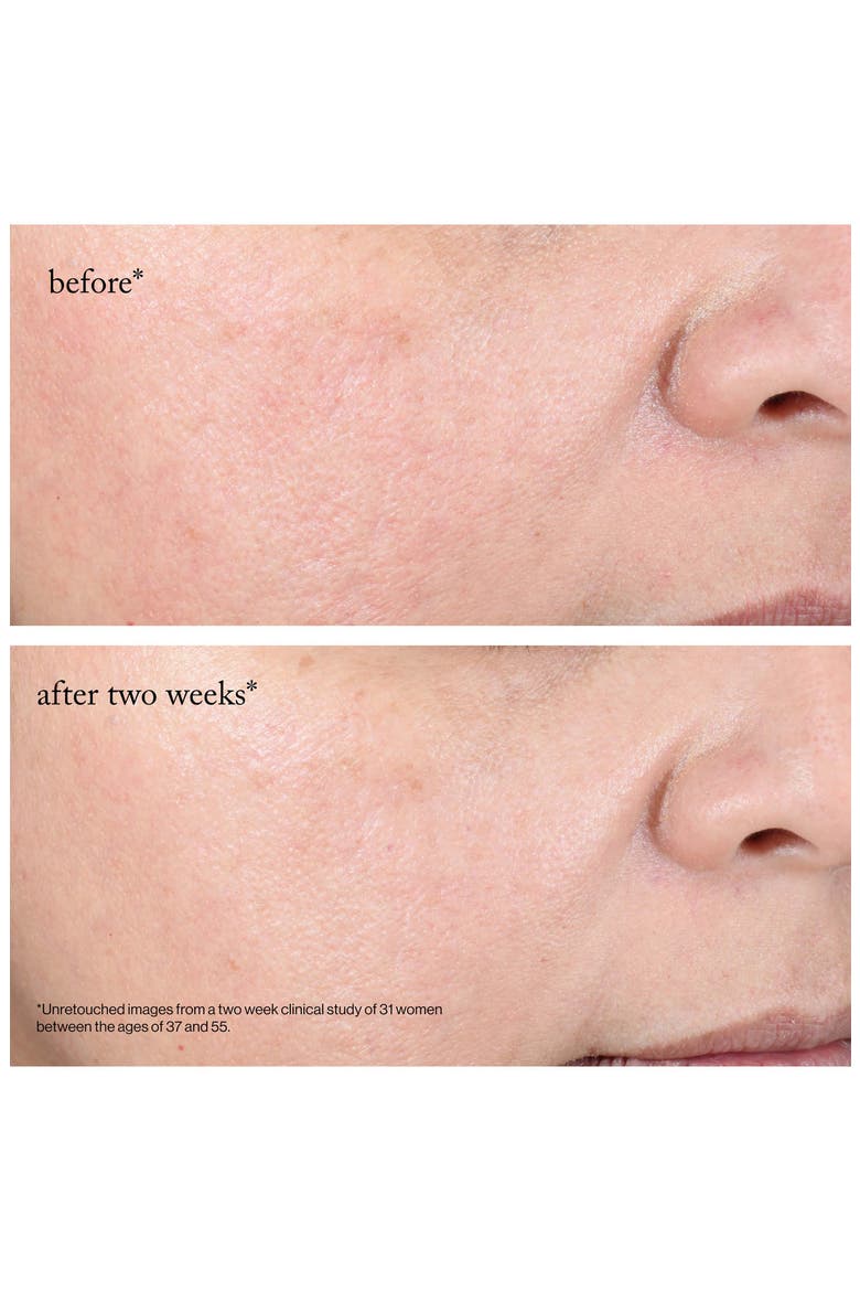 15% Glycolic Acid Overnight Glow Peel Pads - 4 Pack, Alternate, color, NO COLOR
