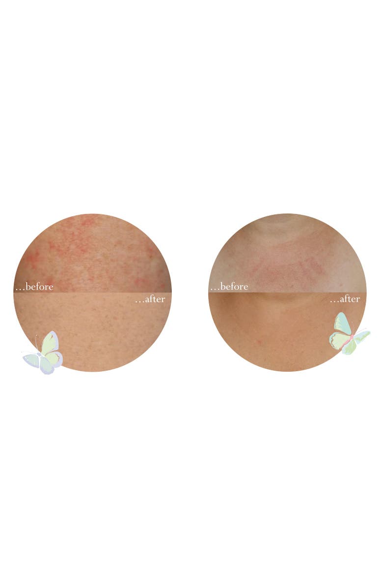 Little Butterfly London Dewdrops at Dawn Body Lotion 200ml, Alternate, color, Body Lotion 200Ml