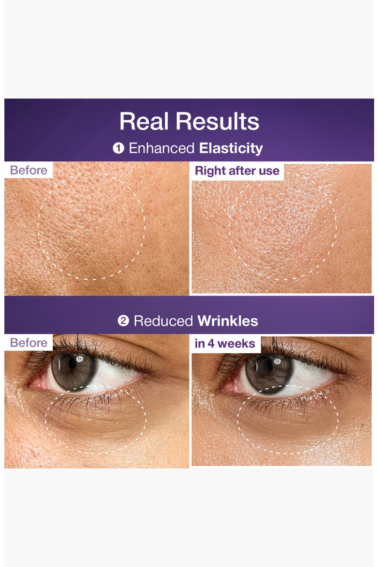 No.9 NAD+ BIO Lifting-sil Essence, Alternate, color, NO COLOR