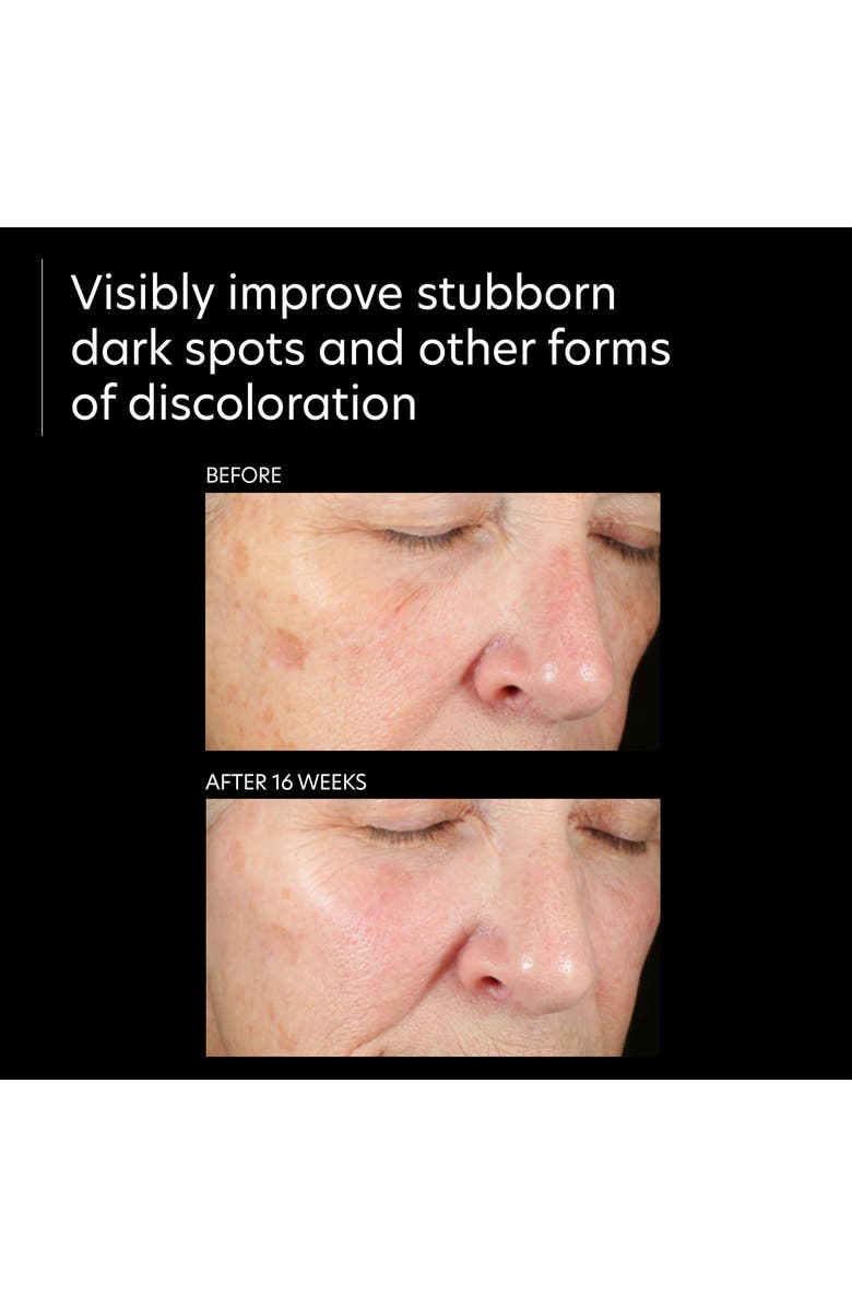 PCA Skin Pigment Gel Pro Intense Dark Spot Corrector, Alternate, color, 