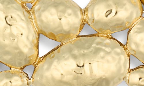 Karine Sultan Hammered Cobblestone Statement Necklace In Gold