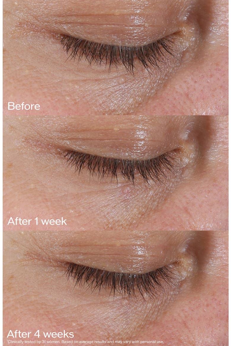 Benefiance NutriPerfect Eye Serum, Alternate, color, NO COLOR