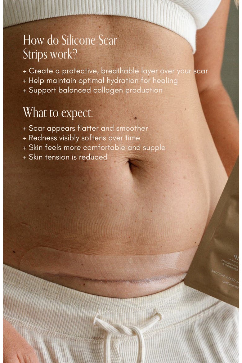 C-Section Scar Care Kit, Alternate, color, No color