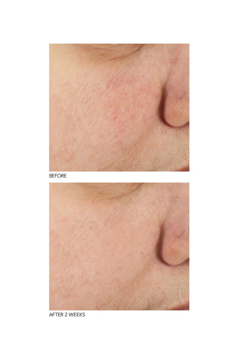 B3Adaptive SuperFoods™ Stress Repair Face Cream, Alternate, color, NO COLOR