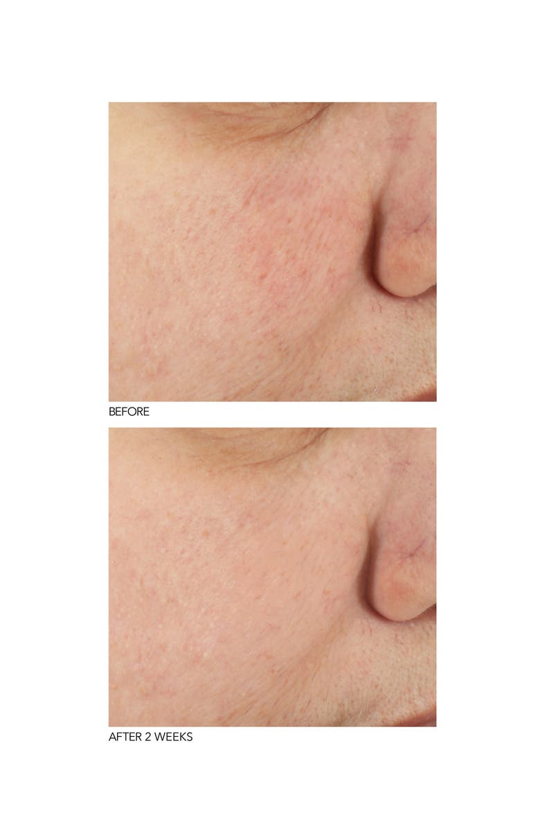 Dr. Dennis Gross Skincare B3Adaptive SuperFoods<sup>™</sup> Stress Repair Face Cream, Alternate, color, 