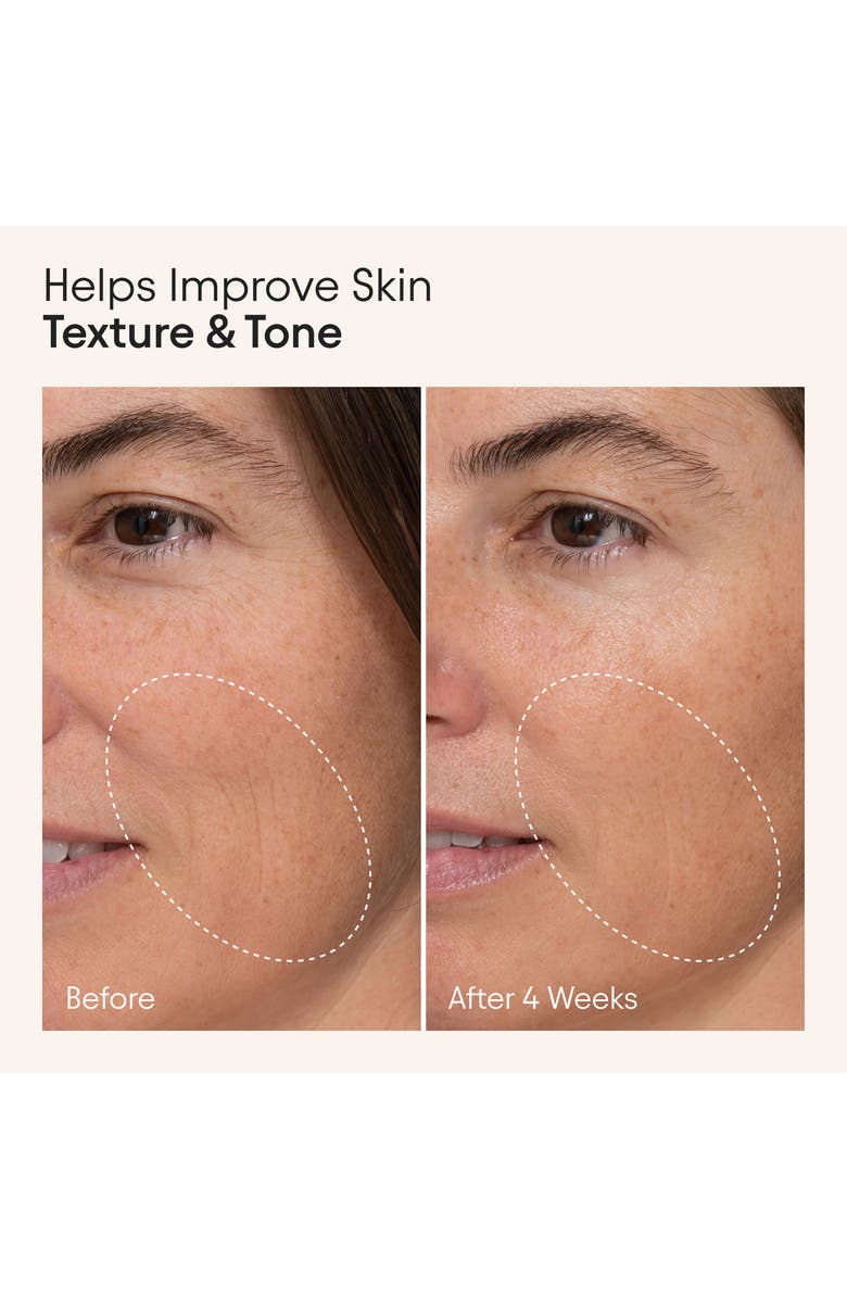 Alpyn Firming Serum with Niacinamide & Nettle, Alternate, color,