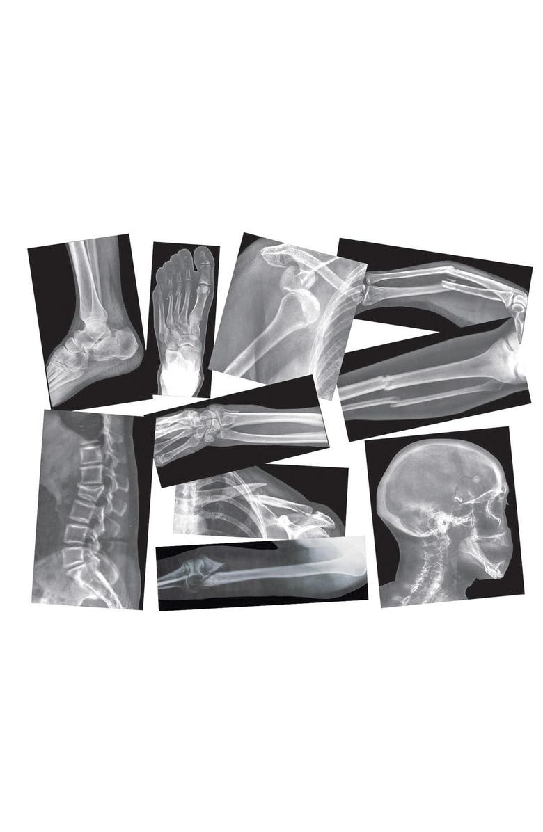 Roylco Broken Bones X-Rays, Main, color, Multicolor