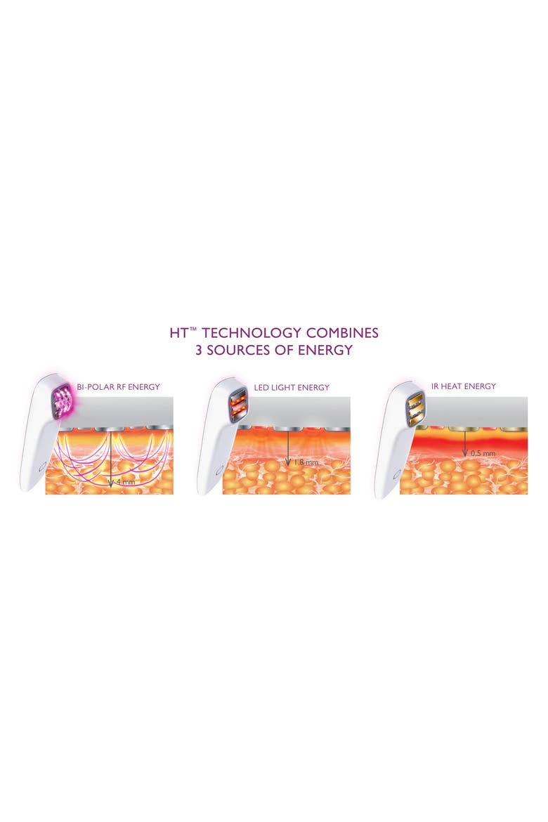 Titan Skin Tightening and Lifting, Alternate, color, WHITE