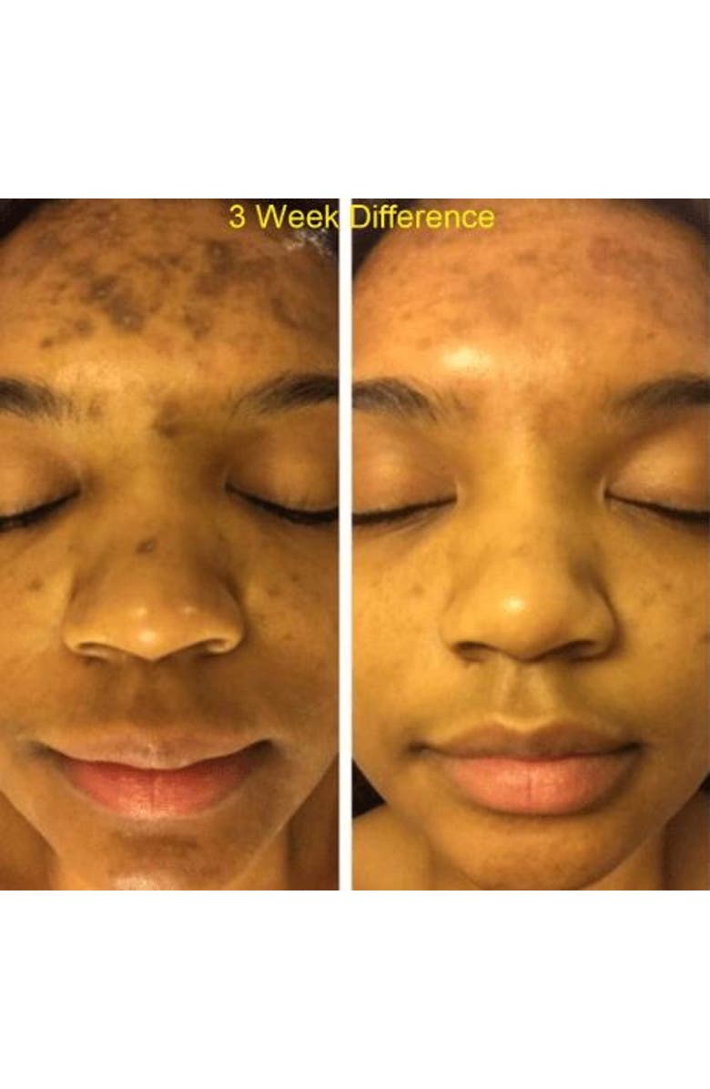 Admire My Skin Ultra Potent Brightening Serum Dark Spot Corrector, Alternate, color, Clear