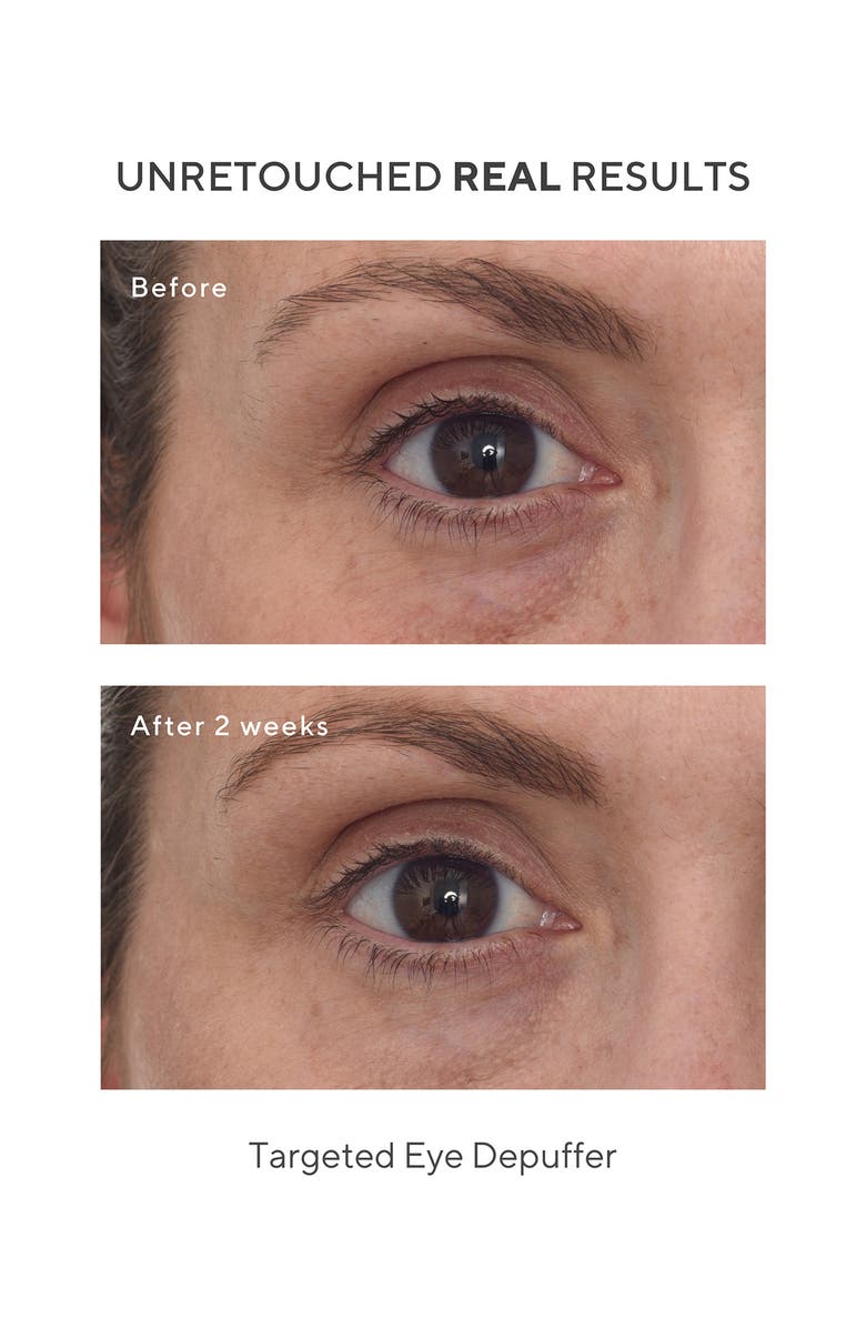 Murad<sup>®</sup> Targeted Eye Depuffer, Alternate, color,