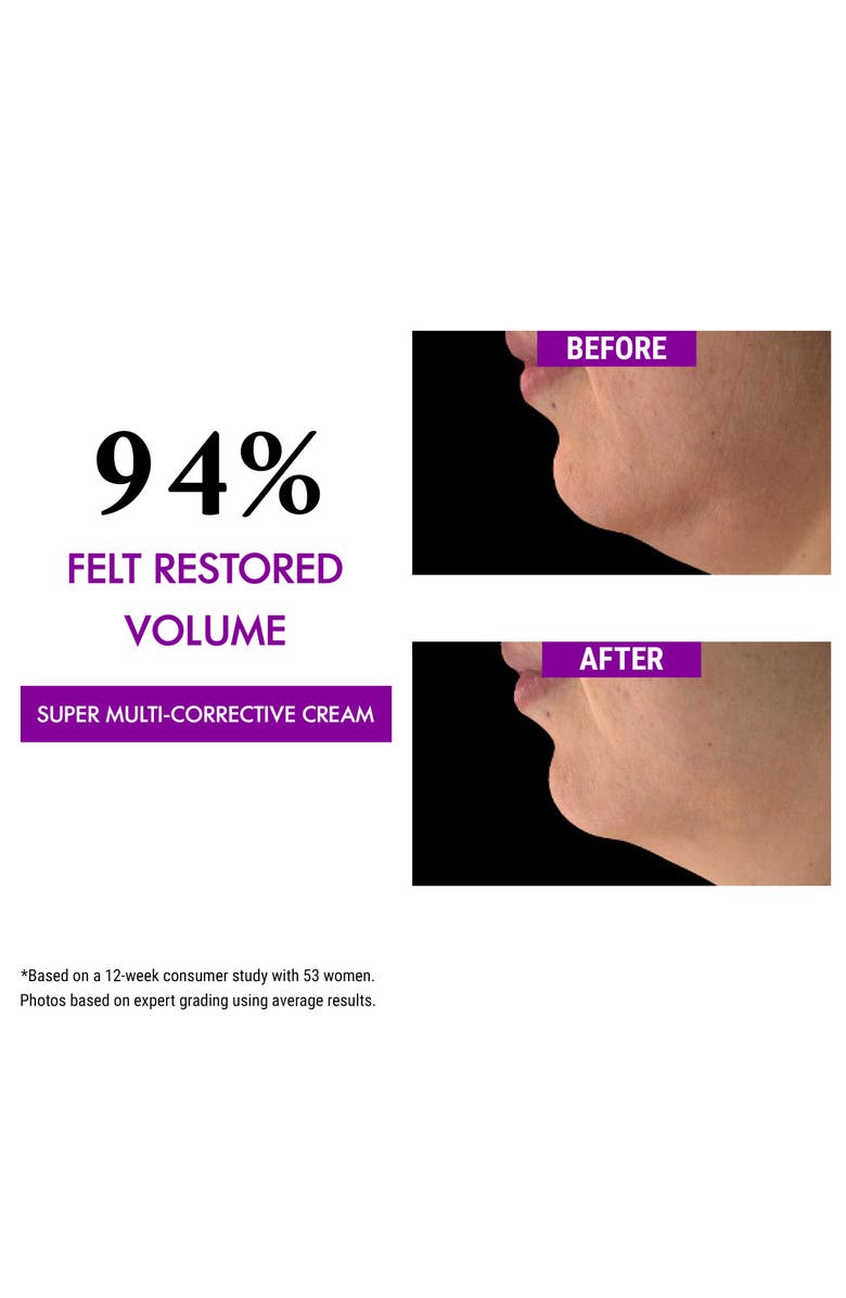 Kiehl's Since 1851 Super Multi-Correctors for Face & Eye Set $105 Value, Alternate, color, 