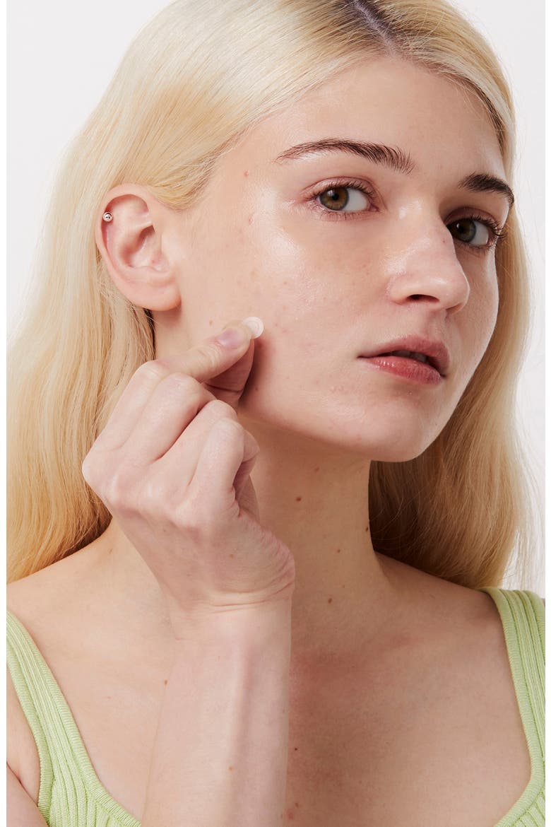 Timeout Blemish Patches, Alternate, color, NO COLOR