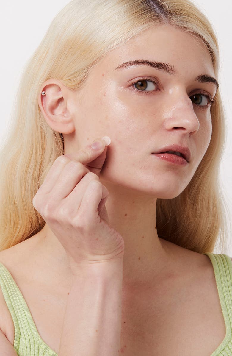 I DEW CARE Timeout Blemish Patches, Alternate, color, 