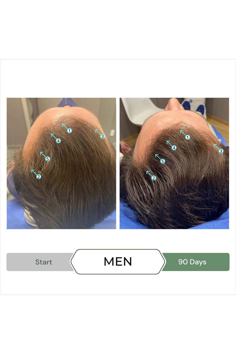 Revita.CBD Super Antioxidant Hair Density CBD Conditioner, Alternate, color, No Color