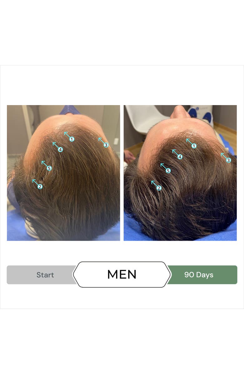 DS Laboratories Revita.CBD Super Antioxidant Hair Density CBD Conditioner, Alternate, color, NO COLOR