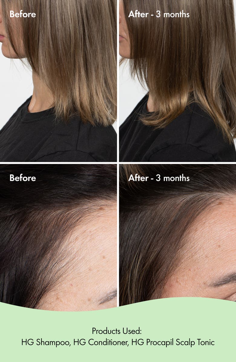 BONDI BOOST HG Shampoo, Alternate, color, 