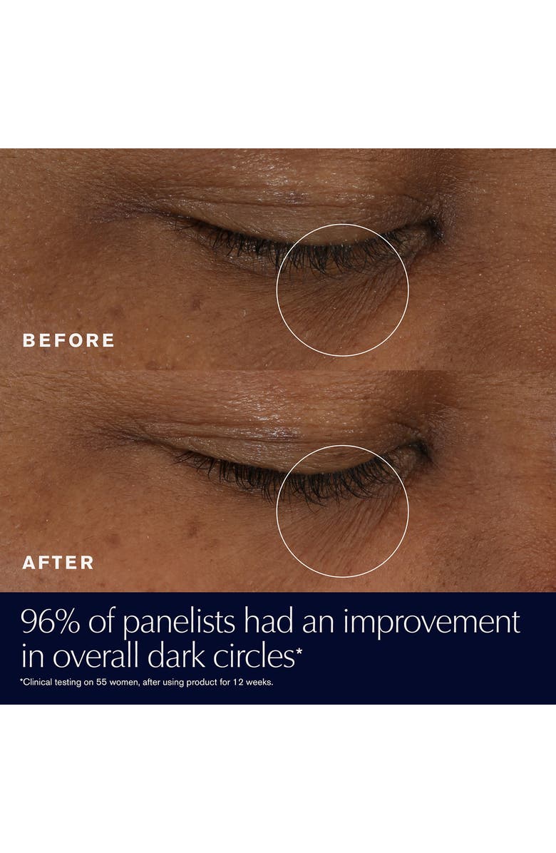 Estée Lauder Advanced Night Repair Supercharged Gel Eye Cream, Alternate, color, 