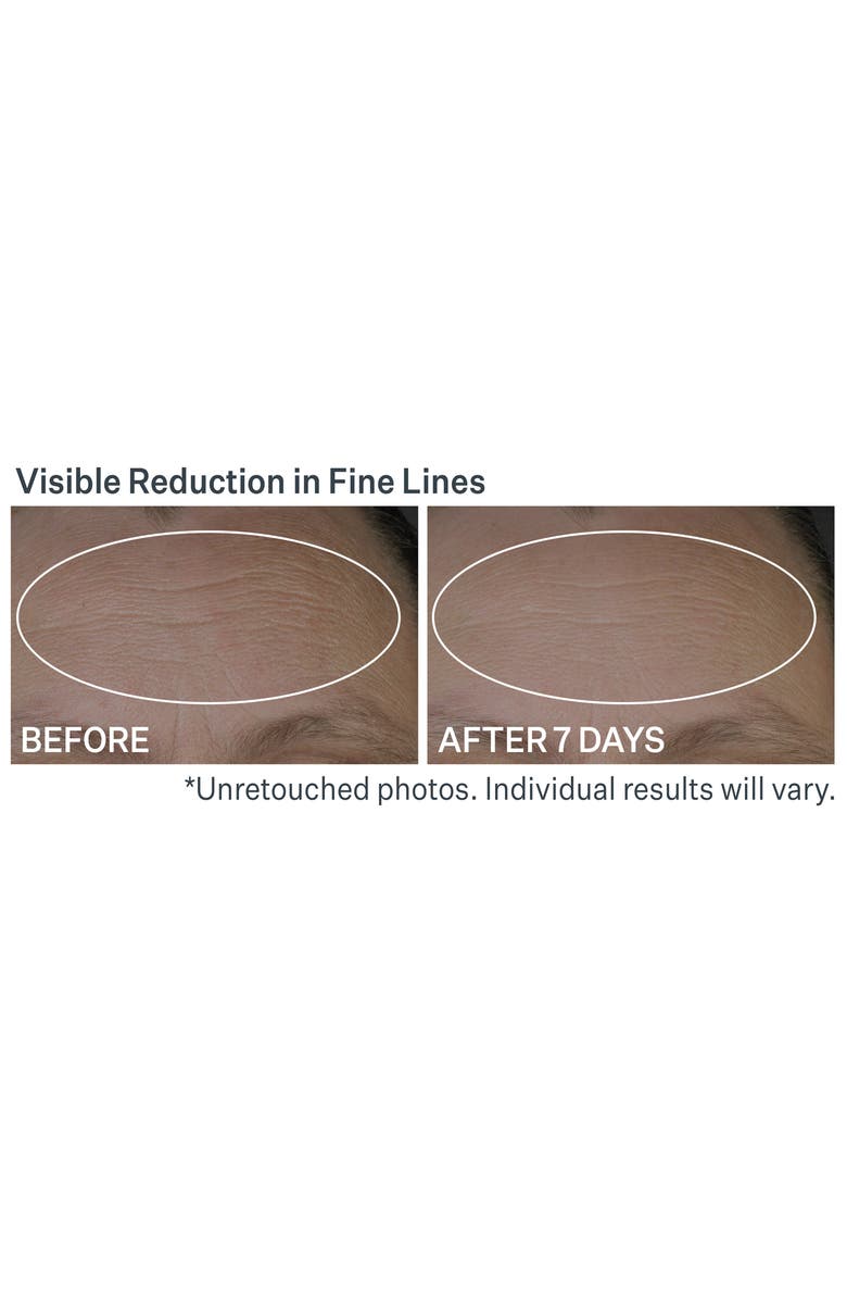 StriVectin<sup>®</sup> Anti-Wrinkle Peptide Plump<sup>™</sup> Line Filling Bounce Serum, Alternate, color,