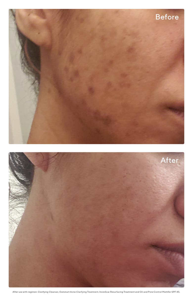 Murad<sup>®</sup> Oil and Pore Control Mattifier SPF 45, Alternate, color,