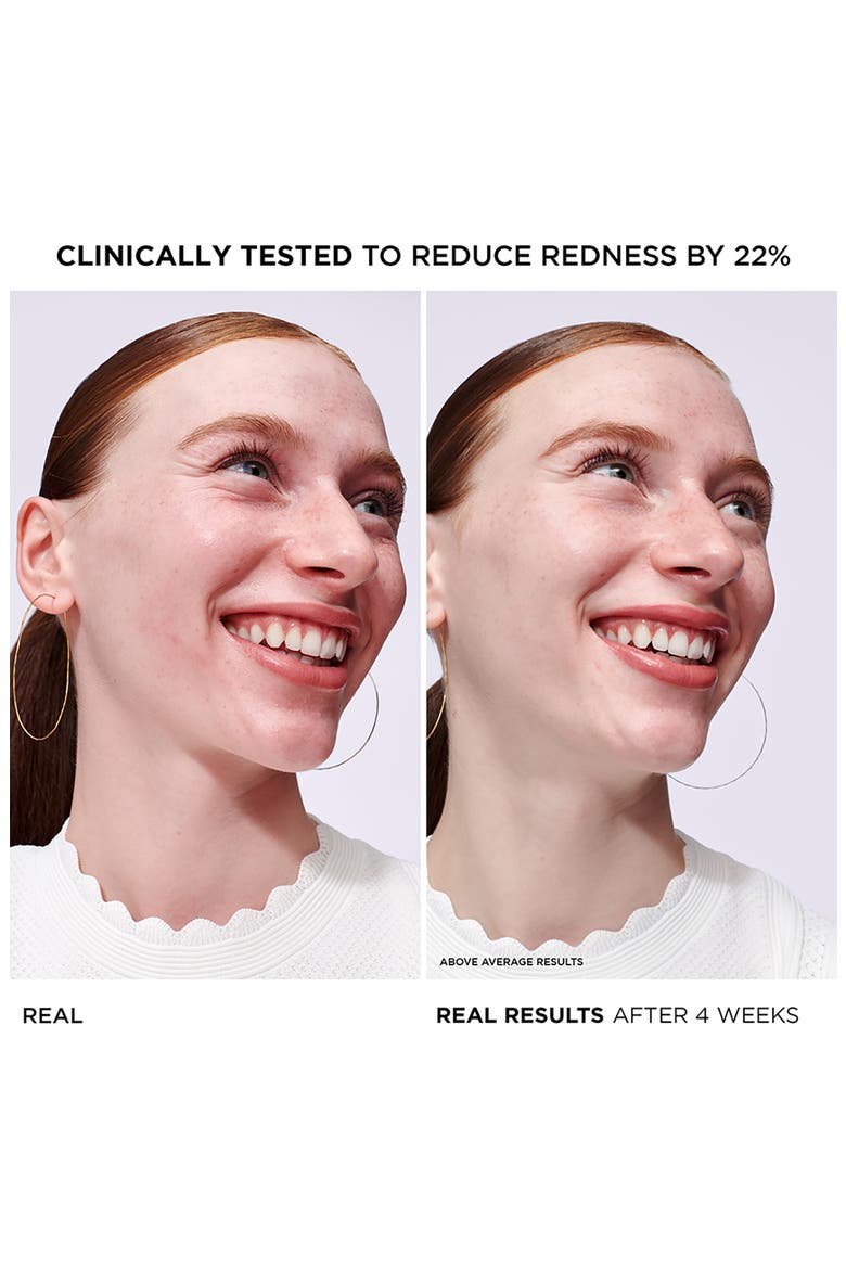 Bye Bye Redness Concentrated Derma Serum, Alternate, color, NO COLOR