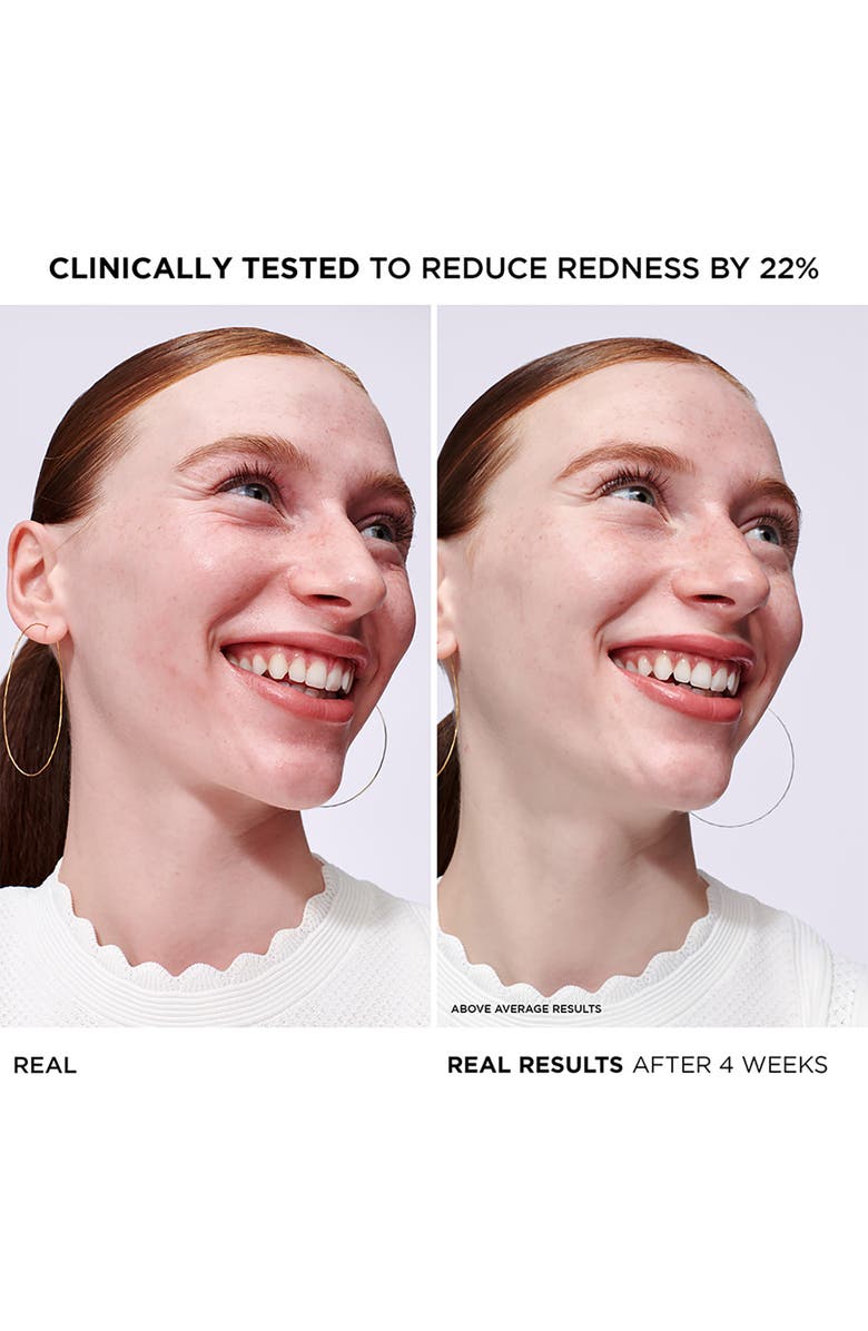 IT Cosmetics Bye Bye Redness Concentrated Derma Serum, Alternate, color, 