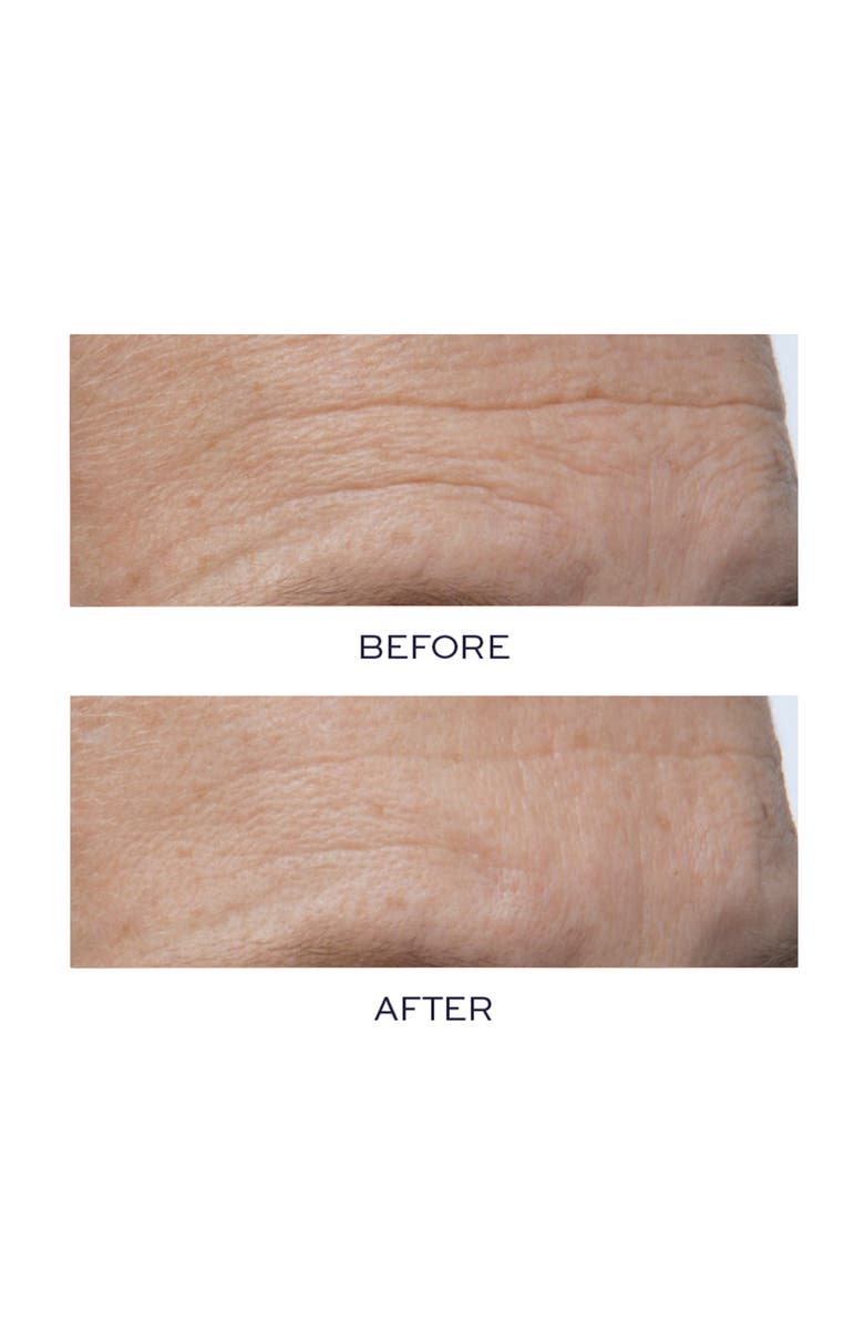 Elemis Pro-Collagen Super Serum Elixir, Alternate, color,