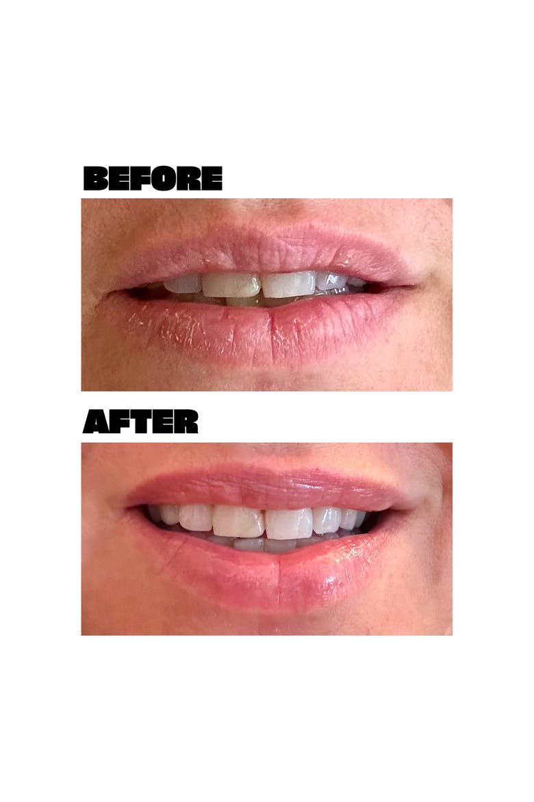 Lip Mask, Alternate, color, None