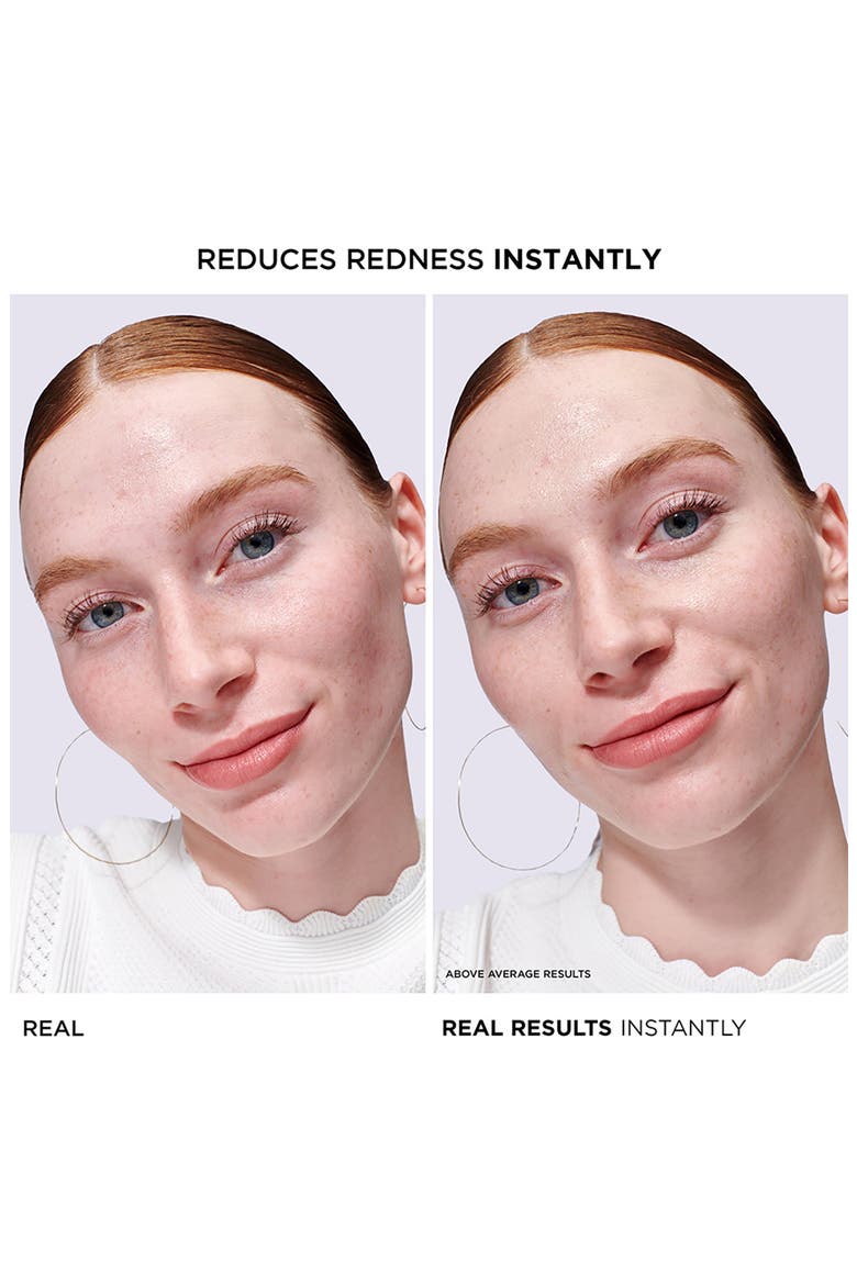 Bye Bye Redness Concentrated Derma Serum, Alternate, color, NO COLOR