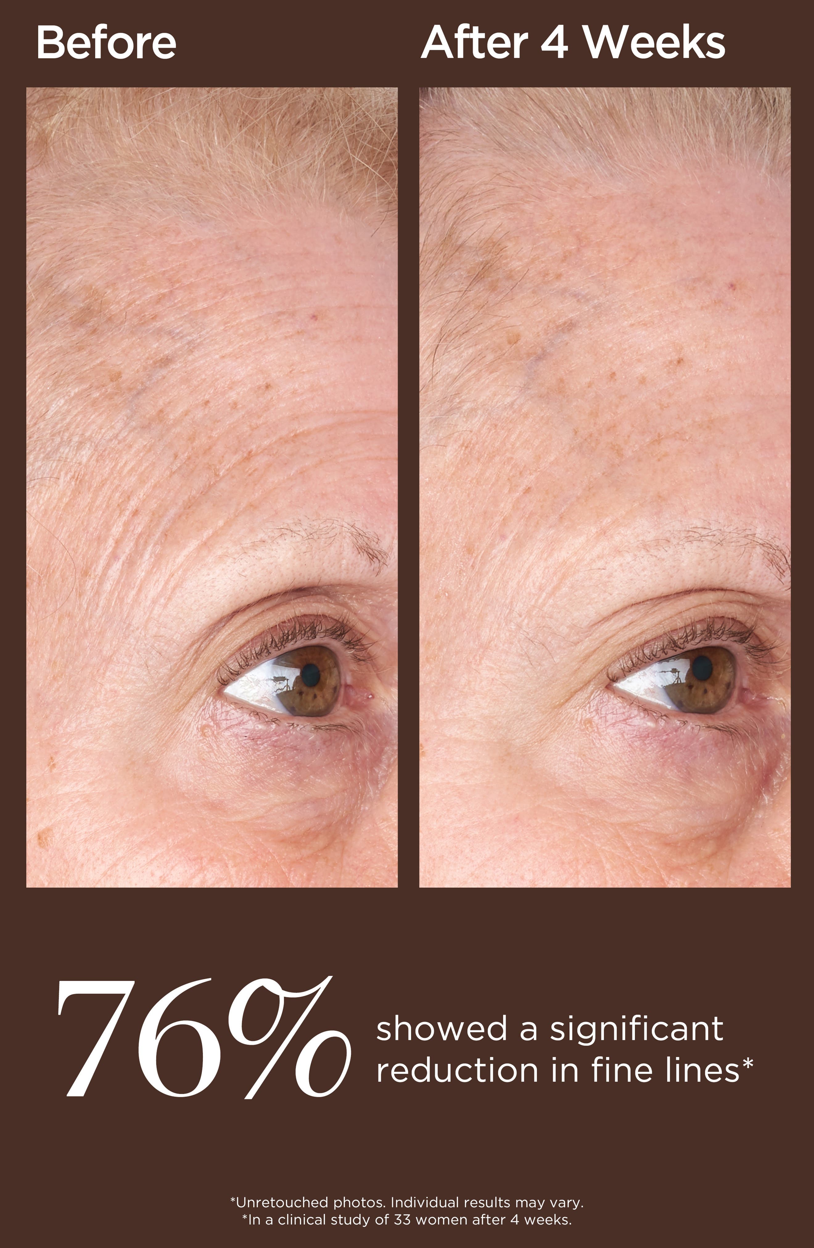 Perricone MD High Potency Classics Face Finishing & Firming