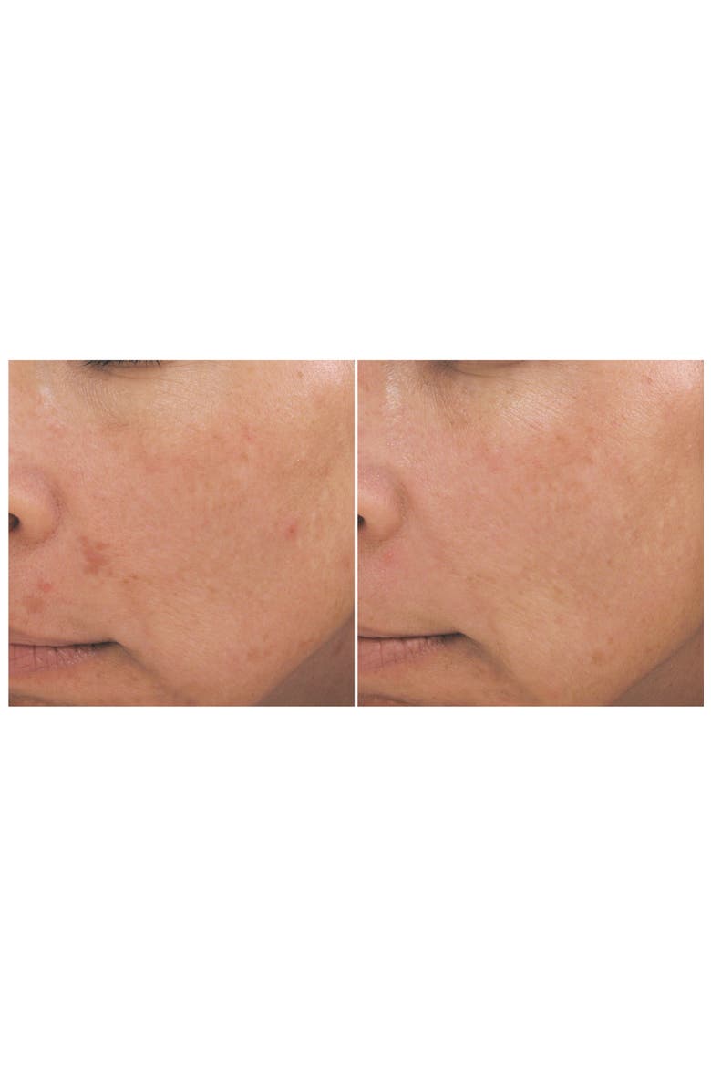 Intensive Brightening Treatment, Alternate, color, NO COLOR