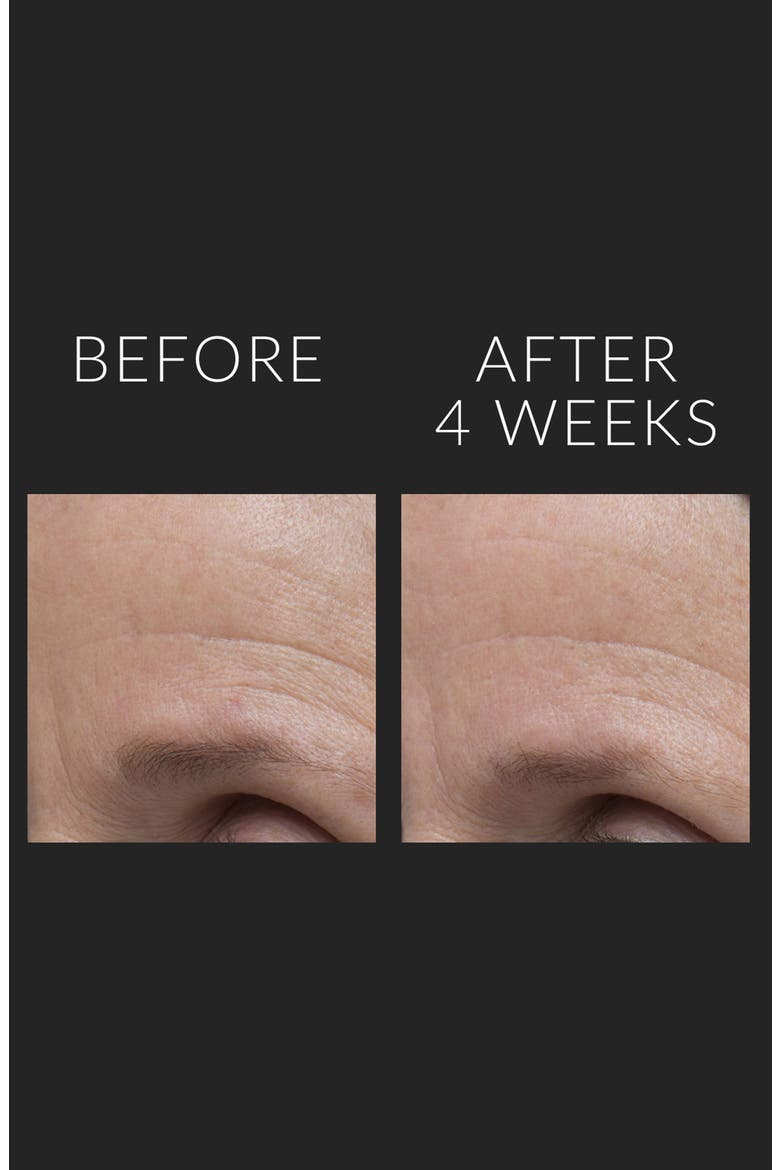 DermalQuench Liquid Lift™ + Retinol Advanced Resurfacing Treatment, Alternate, color, NO COLOR