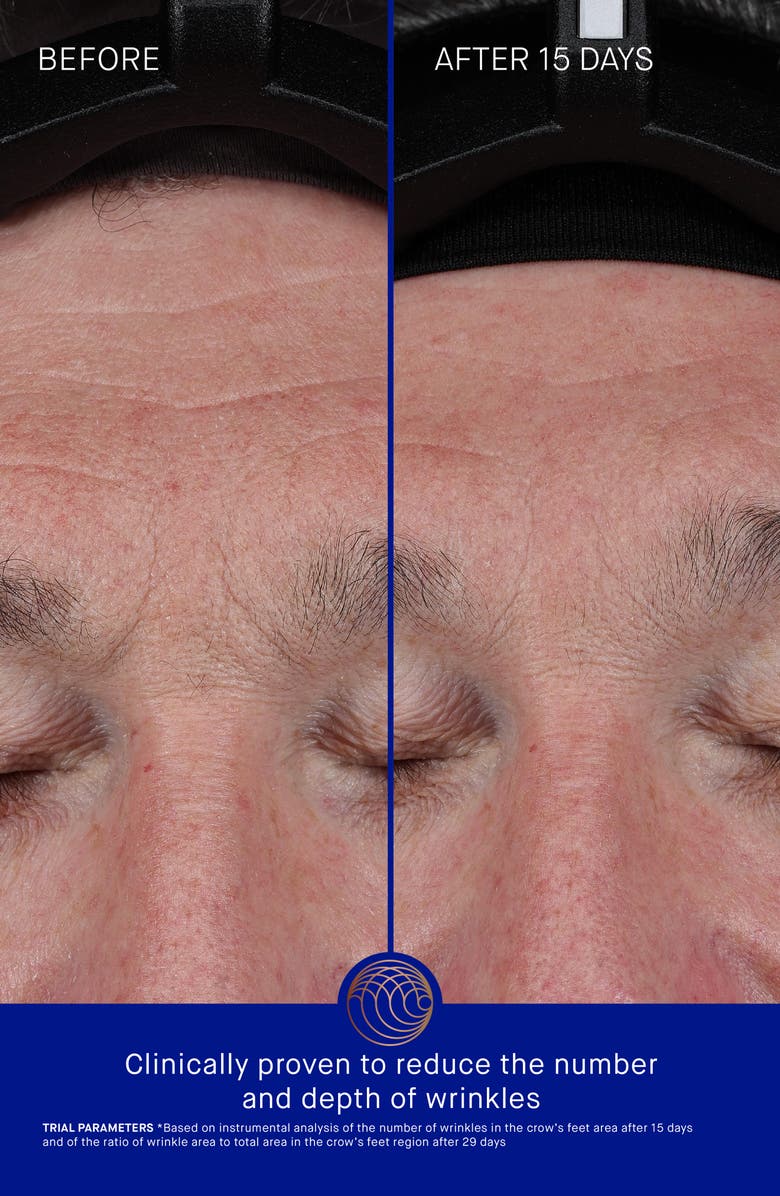 Augustinus Bader The Elixir with Advanced TFC8<sup>®</sup>, Alternate, color,