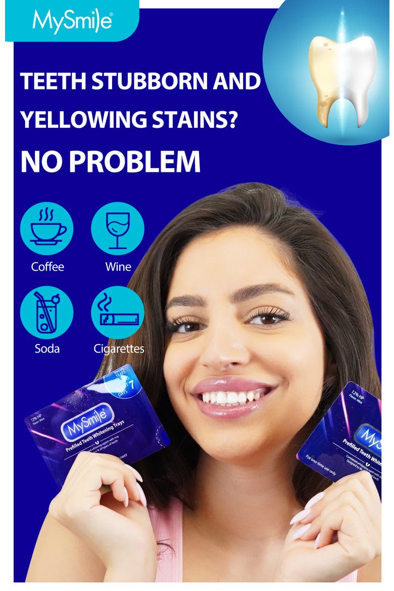 Prefilled Teeth Whitening Trays Kit, 12% Hydrogen Peroxide, Alternate, color, Purple