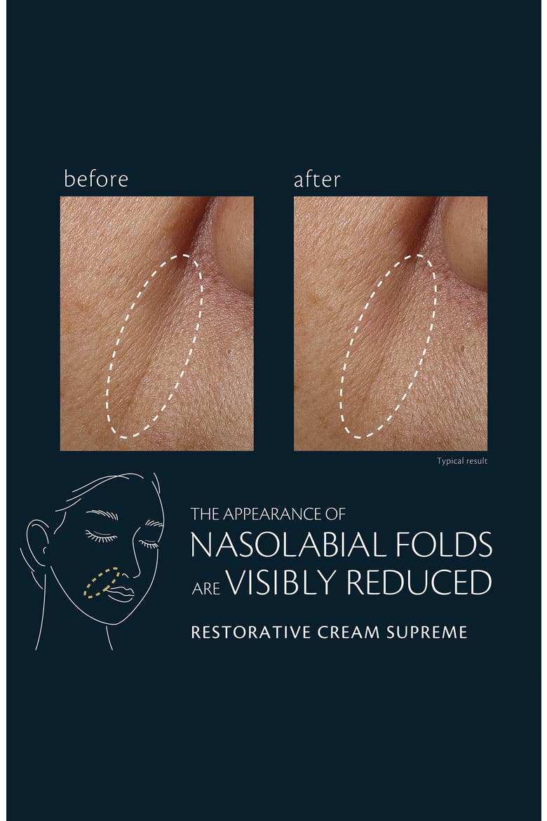 Restorative Cream Supreme Refill, Alternate, color, REGULAR