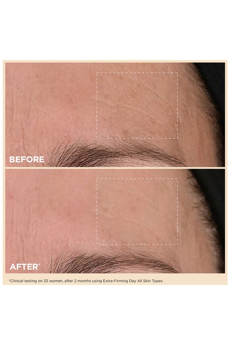 Extra-Firming Luxury Skin Care Gift Set with Collagen Polypeptide & Niacinamide $300 Value, Alternate, color, NO COLOR