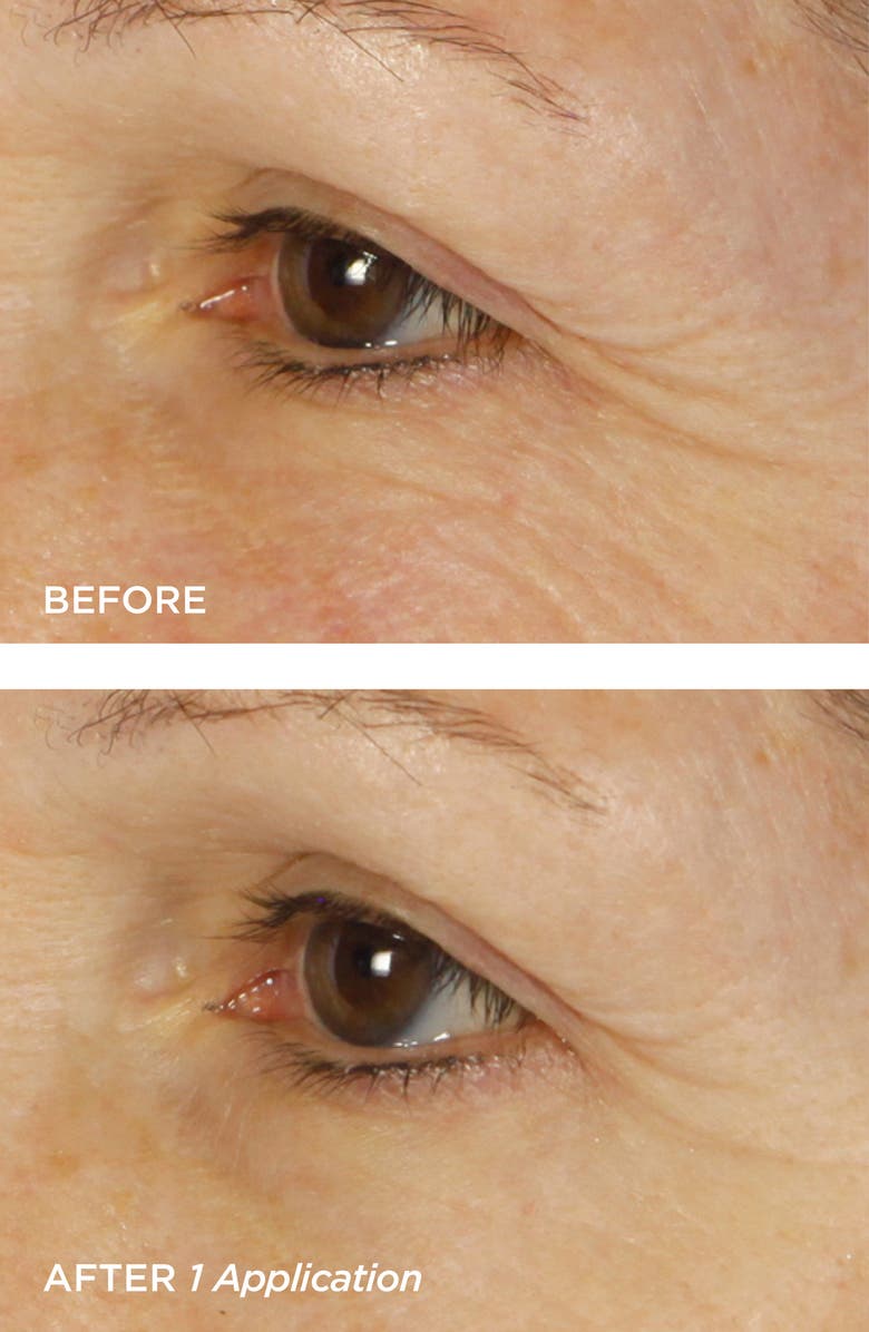 BeautyBio Bright Eyes Set, Alternate, color, 