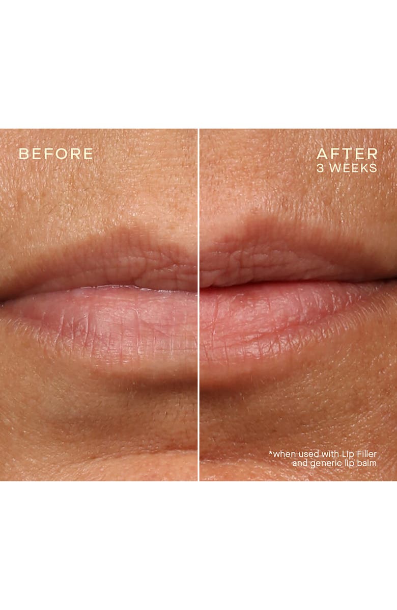 Ourself Lip Filler & Refill Cartridge Set, Alternate, color,