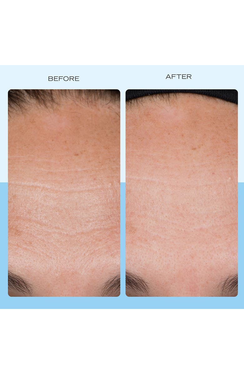 First Aid Beauty Ultra Repair Firming Collagen Cream, Alternate, color, 