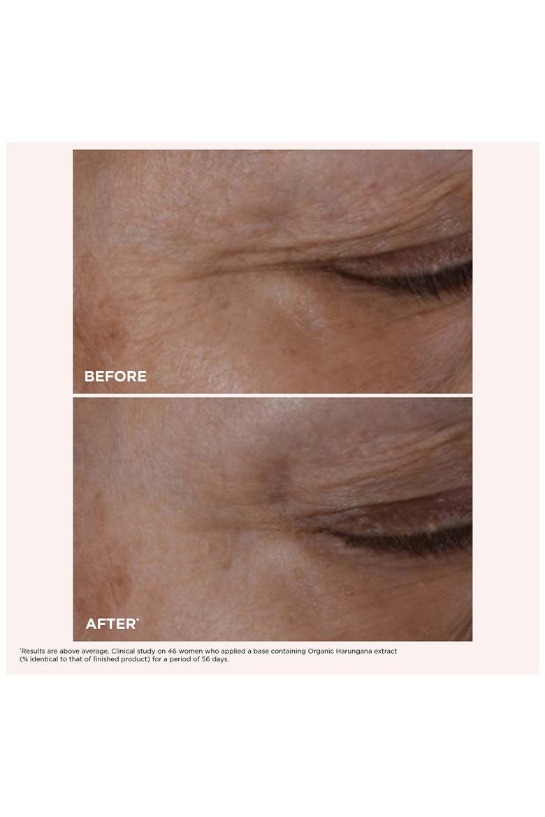 Total Eye Lift Eye Cream & Refill Set (Nordstrom Exclusive) $173 Value, Alternate, color, NO COLOR
