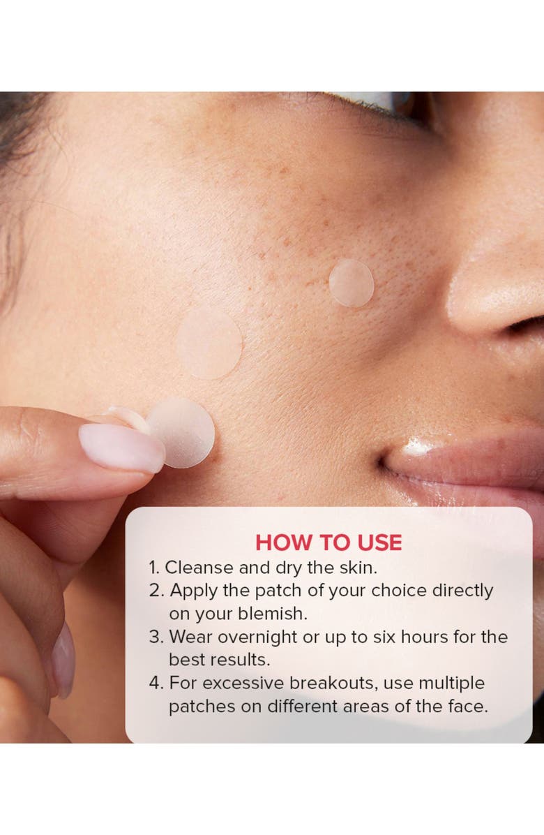 Skin Gym PIMPLEPOOF Blemish Patches, Alternate, color, Pink