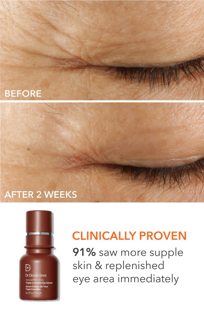 Dr. Dennis Gross Skincare Collagen Boosting Essentials Set $641 Value, Alternate, color,