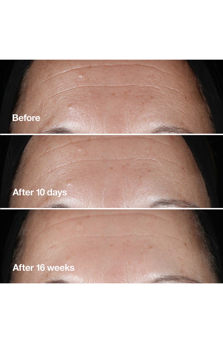 Clinique De-aging Experts Skin Care Set $198.50 Value, Alternate, color, 