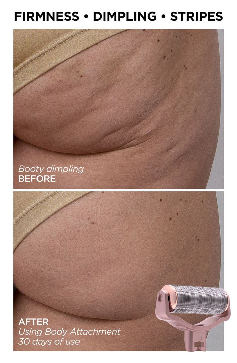 BeautyBio GloPRO<sup>®</sup> Skin & Hair Goals Set $353 Value, Alternate, color, 